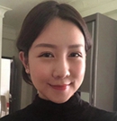 在韩国艾恩做了眼鼻综合后效果很不错又去做了下颌角手术