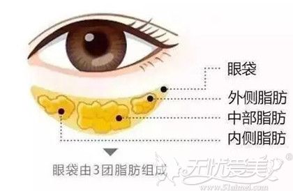 眼袋手术后皱纹变多来郑州羽中整形做去眼袋手术可避免