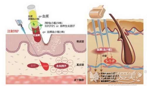 想用发际线修饰脸型的亲可选择长沙岱高的微针植发