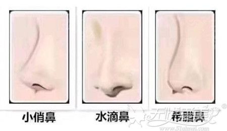 三种鼻型的形态不同