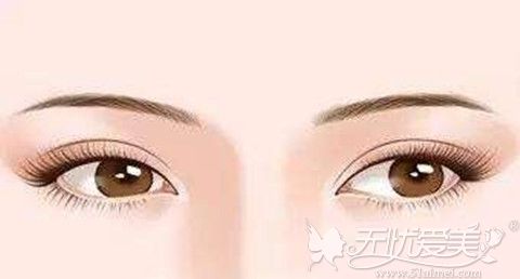 一双美丽的眼睛是很多人向往的眼睛