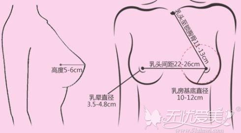 假体隆胸需要根据胸部的条件选择大小