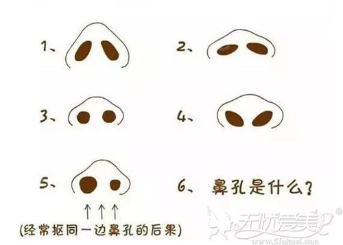 鼻孔的各种形状