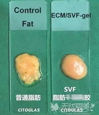脂肪胶和普通脂肪在形态上的区别
