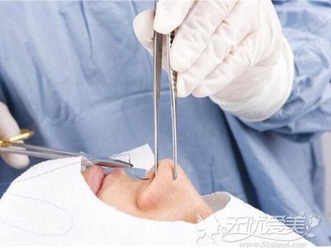 肋骨隆鼻手术非常考验医生的技术