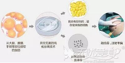 如果胸部填充300毫升的自体脂肪 完全稳定后能有多大