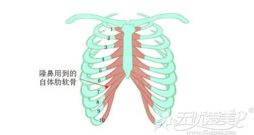 做肋骨隆鼻我倒是不担心老了会怎么样,比较担心4个月后会塌