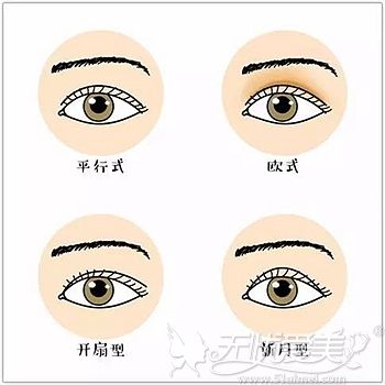 双眼皮手术的不同类型