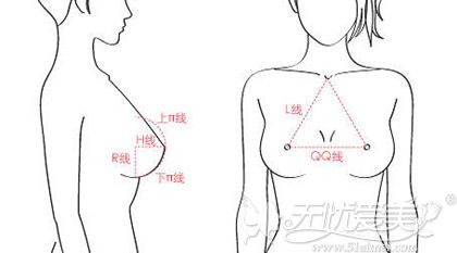 假体隆胸手术前医生会根据胸部比例选择适合的假体大小