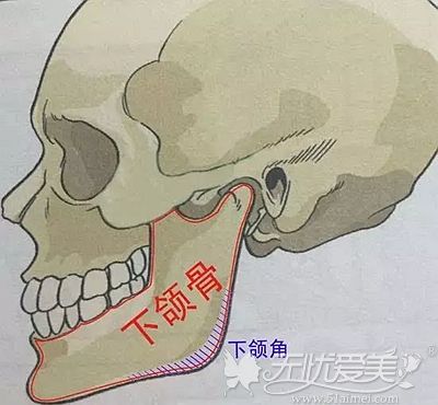 下颌角宽大是造成大方脸的原因