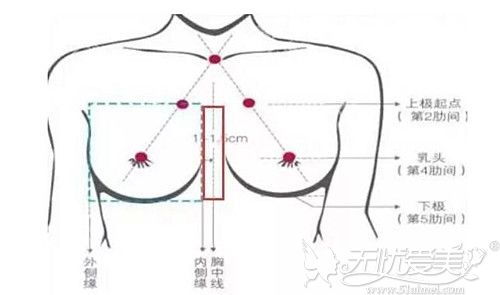 假体隆胸手术胸部设计基础
