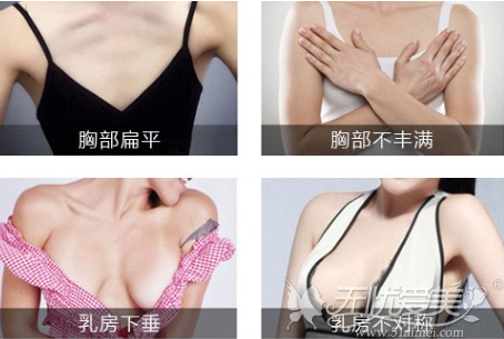 乳房下垂选择假体+自体脂肪隆胸后手感更柔软