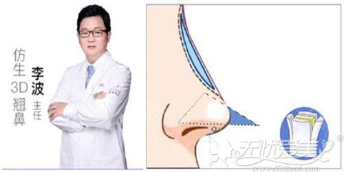 李波医生鼻修复原理