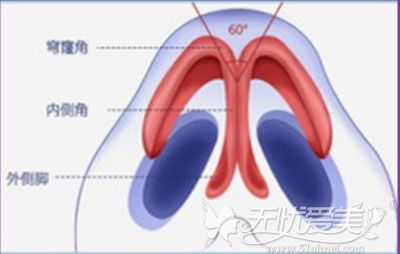 自体软骨隆鼻的弧度