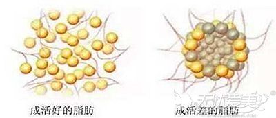 面部脂肪填充后脂肪细胞的成活率