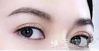 郑京湘做双眼皮手术的优势