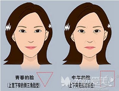 一张全脸埋线提升过程图片戳破脸部埋线以后老的快的谎言