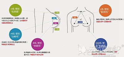 叶明龙院长在隆胸方面的技术优势