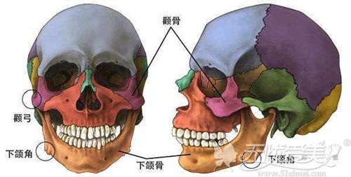 颧骨和下颌角宽需要进行磨骨手术