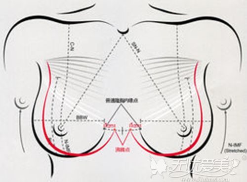 昆明安德丽双C丰胸术跟普通的假体隆胸相比有什么区别吗？