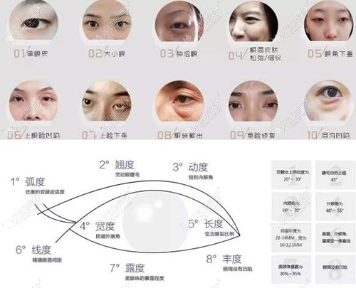 眼综合和双眼皮的区别:前者虽然贵但是项目上改变的多