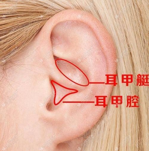 耳软骨鼻综合取耳软骨的部位