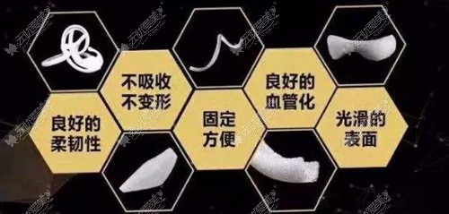 超肋骨隆鼻用的是美国舒铂假体，价格比用自体肋骨高