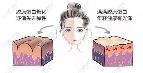 热玛吉适应人群