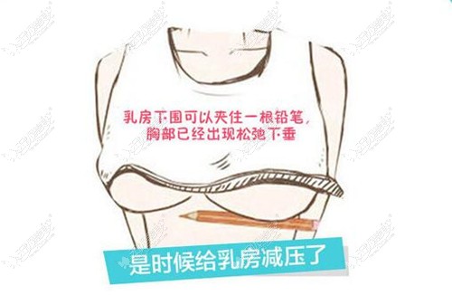胸部下垂自测方法