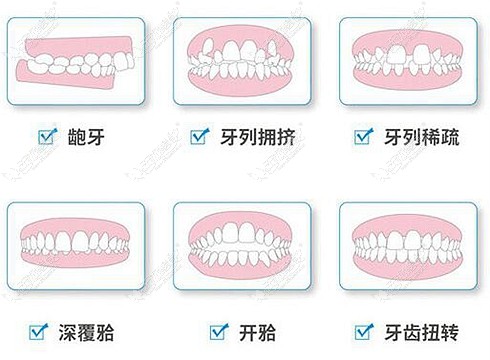 不同类型的牙齿问题