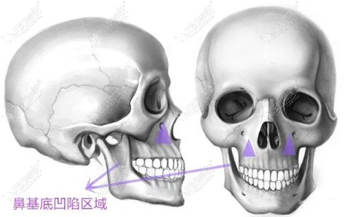 用肋软骨垫鼻基底会不会移位,得看软骨颗粒填充在哪个位置
