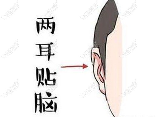 广州余文林做贴发耳的费用要2万多,但他做耳朵很厉害是真的