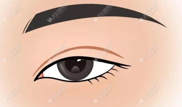 上海美莱双眼皮修复哪个医生好？有案例吗价格贵吗？