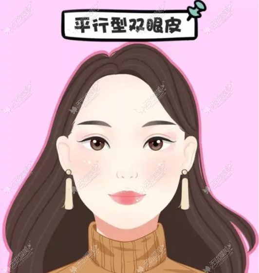 51aimei.com上海薇琳杨荣华做的双眼皮实例