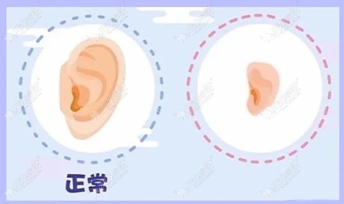 重庆小耳畸形修复医院排名:做耳再造好的重庆松山上榜前三