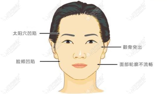 袁玉坤医生脂肪整形好 袁玉坤医生脂肪整形好